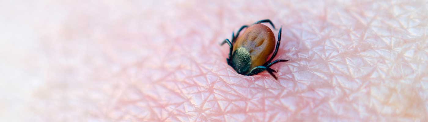 Tickborn diseases